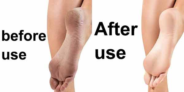 Pierre ponce pour pieds, corps et mains